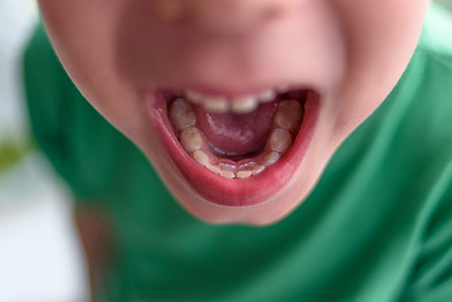 dentista-infantil-granada-dientes-boca