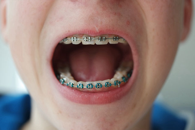 dentista-infantil-granada-ortodoncia
