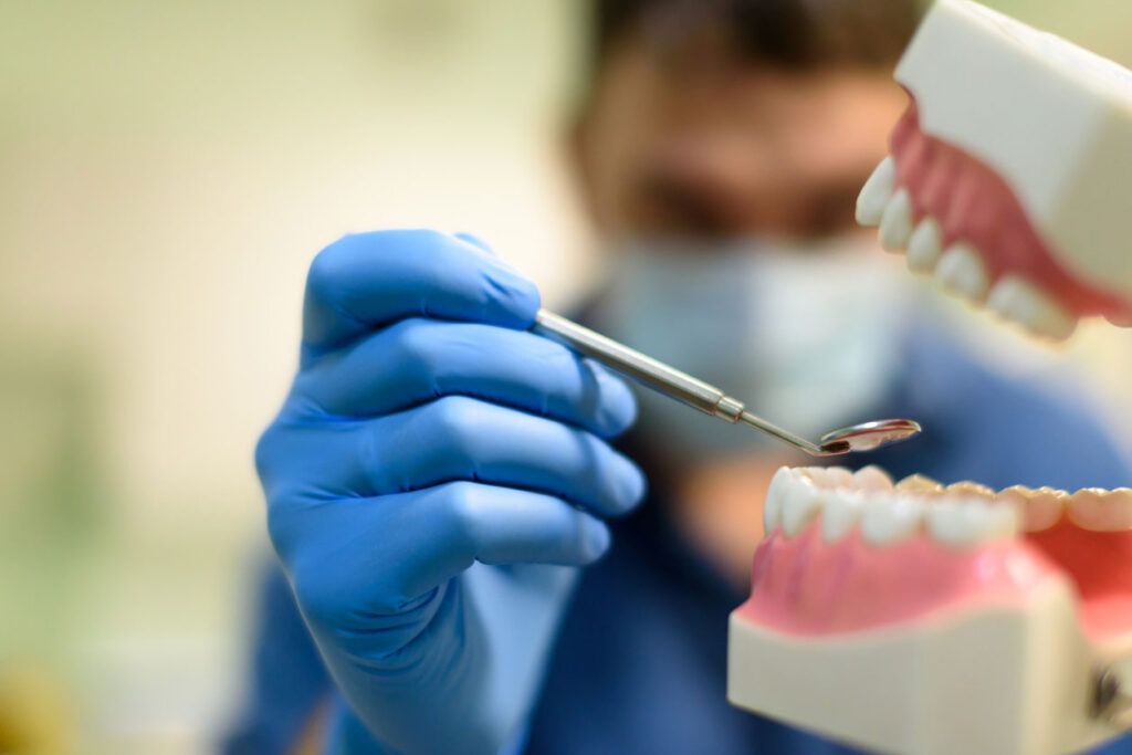 periodontitis-avanzada-curetaje-dental