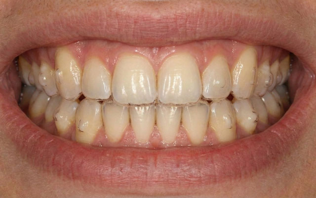 orto-invi-despu orto-invi-despu